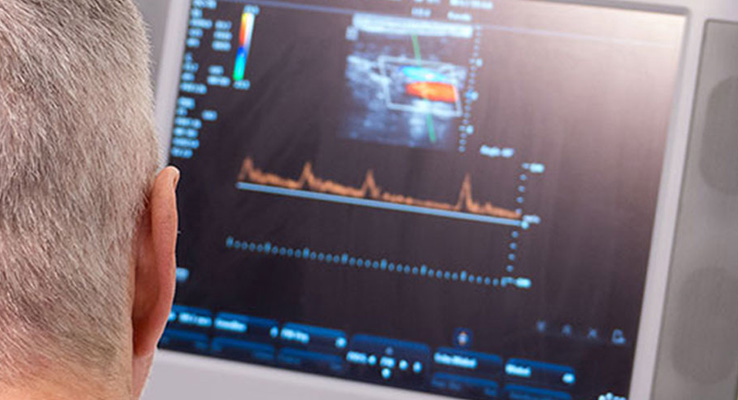 Mann bei einer Doppler-Ultraschalluntersuchung