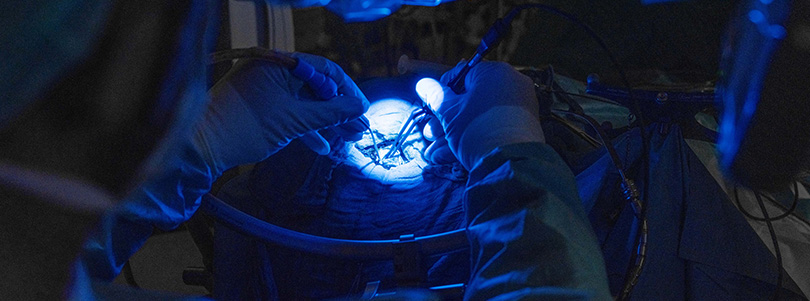 Fluoreszenzdarstellung während einer Gehirnoperation Blau beleuchtetes Operationsfeld während eines neurochirurgischen Eingriffs