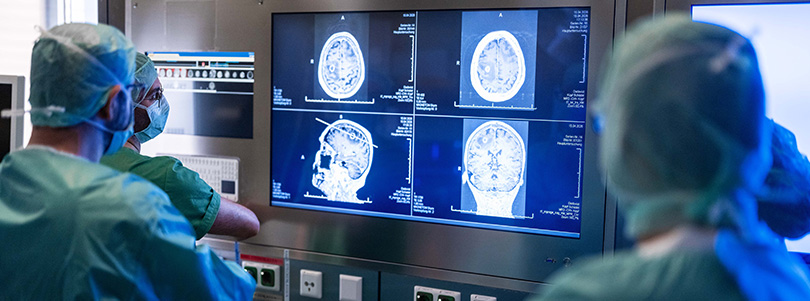 Bildgestützte Planung einer neurochirurgischen Operation Mitglieder des Operationsteams betrachten MRT-Aufnahmen des Gehirns auf einem Bildschirm